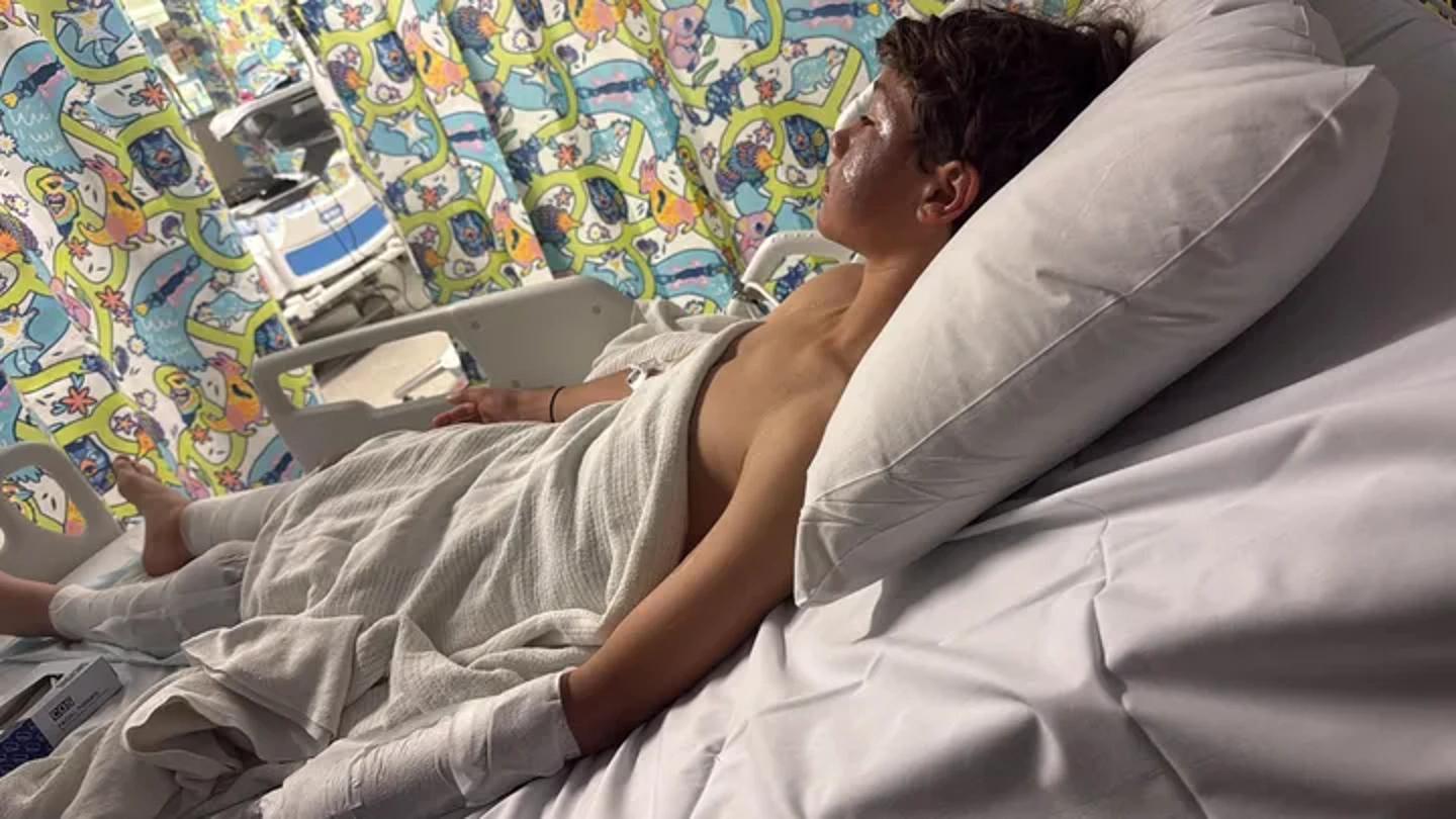 12-Year-Old Soccer Player Suffers Severe Burns After Park Prank Goes Horribly Wrong